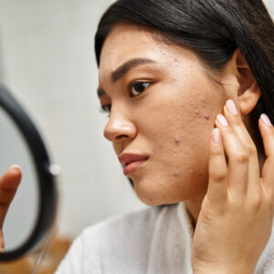 Read more about the article Udah Coba Semua Skincare tapi Jerawat Masih Bandel? Ini Solusinya!